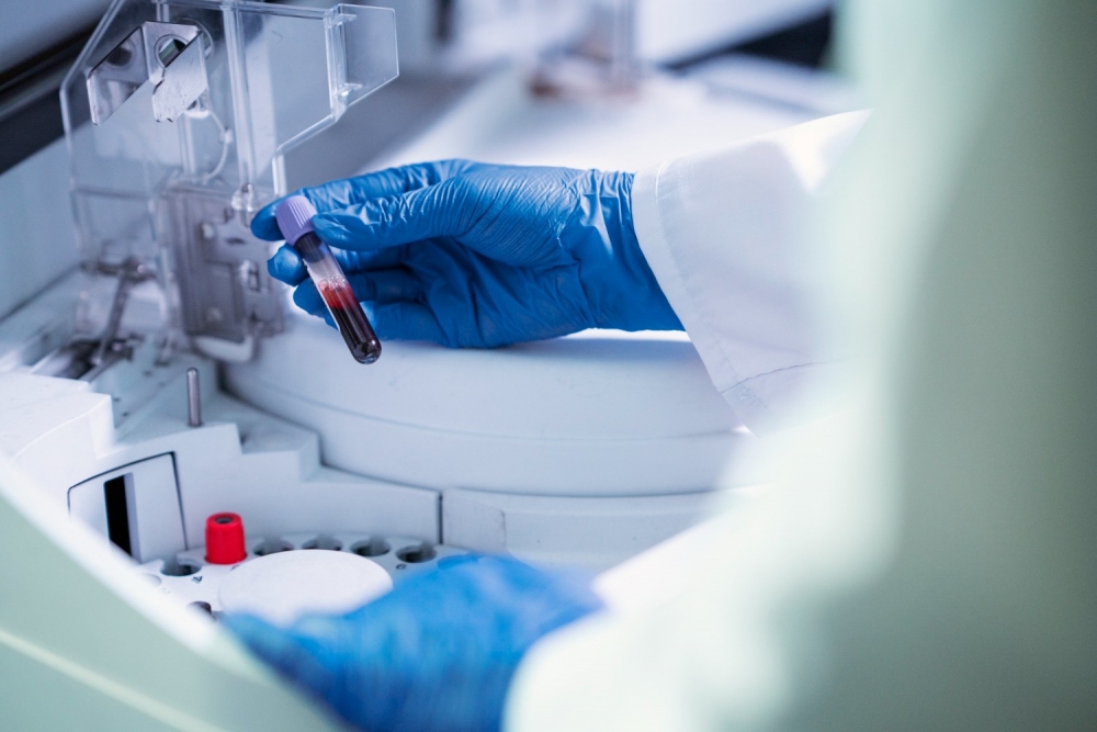 Biobanku likums varētu uzlabot individualizētu ārstēšanu un attīstīt medicīnas iespējas